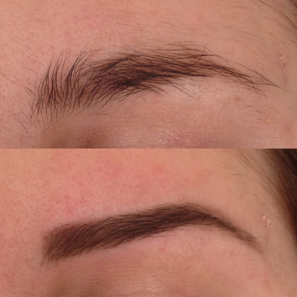 Before & After Threading Gallery Before & After Threading